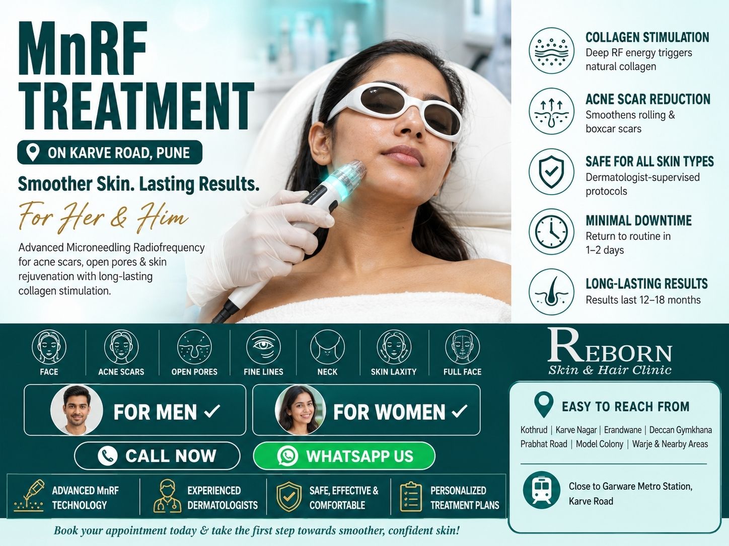 Acne Scar Mnrf Treatment Near Deccan Gymkhana 17830853682