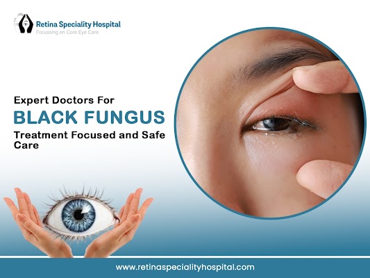 Advanced Black Fungus Eye Surgery In Indore Retina Experts 17545563845