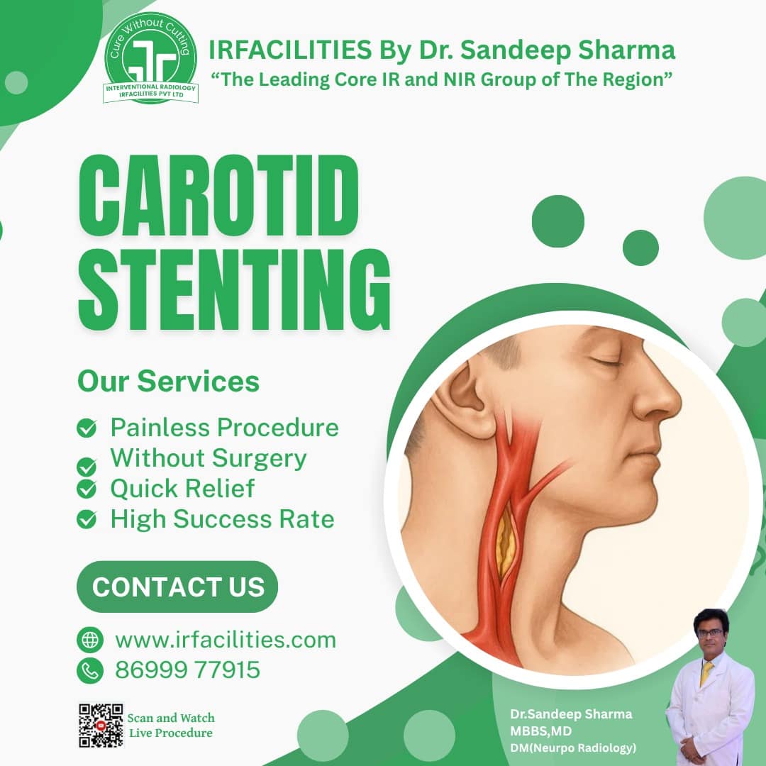 Advanced Carotid Artery Stenting Irfacilities 17843583635