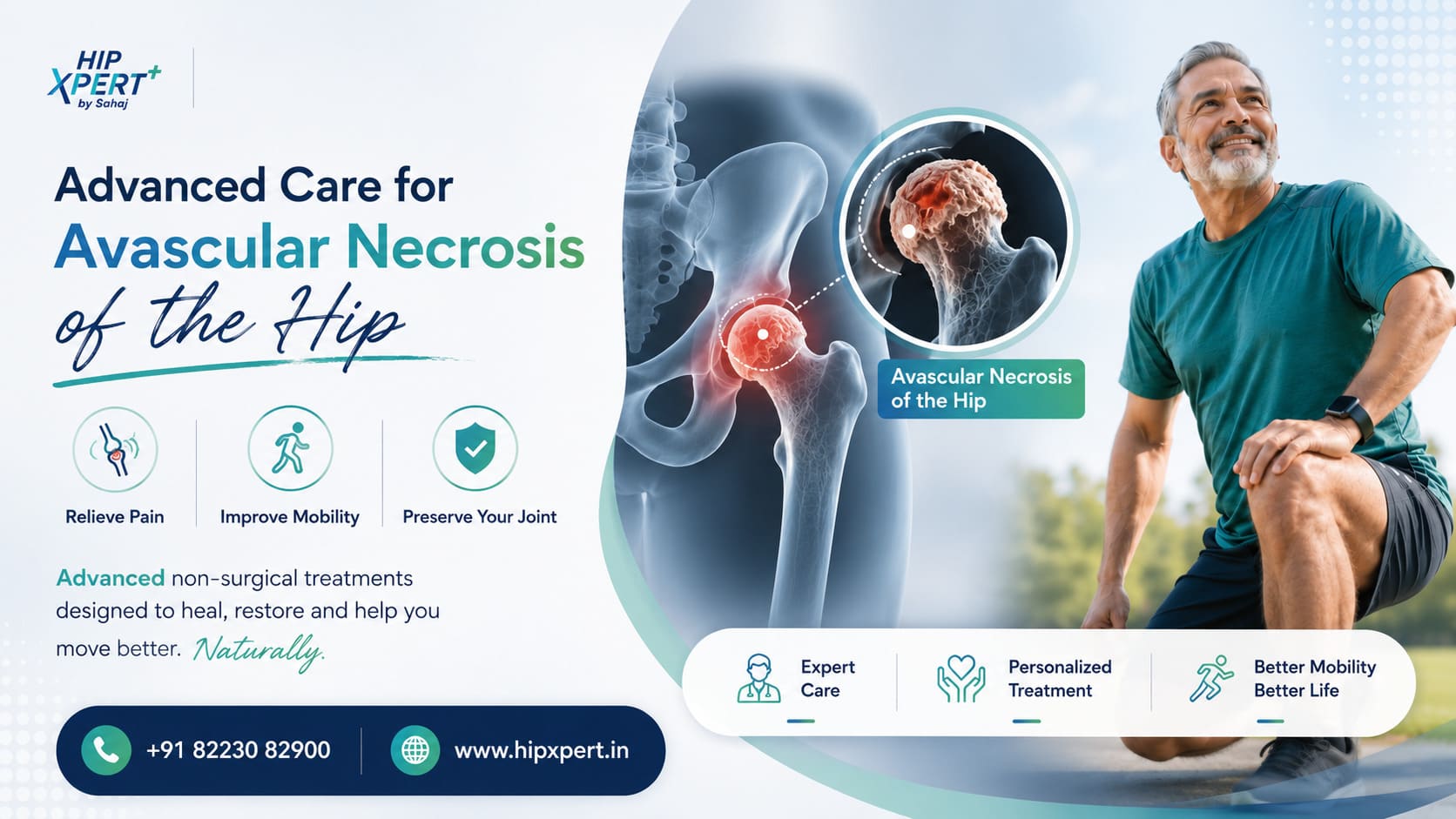 Advanced Non Surgical Treatments For Avascular Necrosis Hipxpert 17791721587