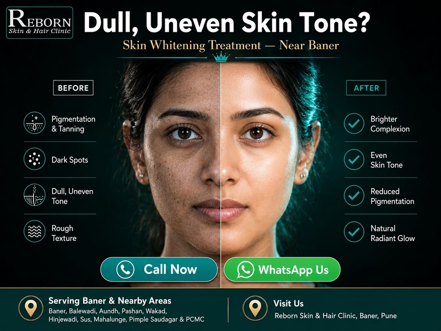 Advanced Skin Whitening Treatment In Baner 17813447138