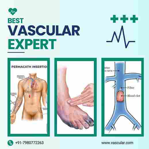 Advanced Vascular Care With The Best Experts In Kolkata 17341467312
