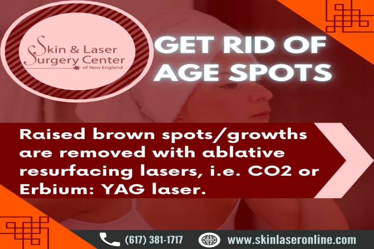 Age Spot Removal Treatment 16412219730