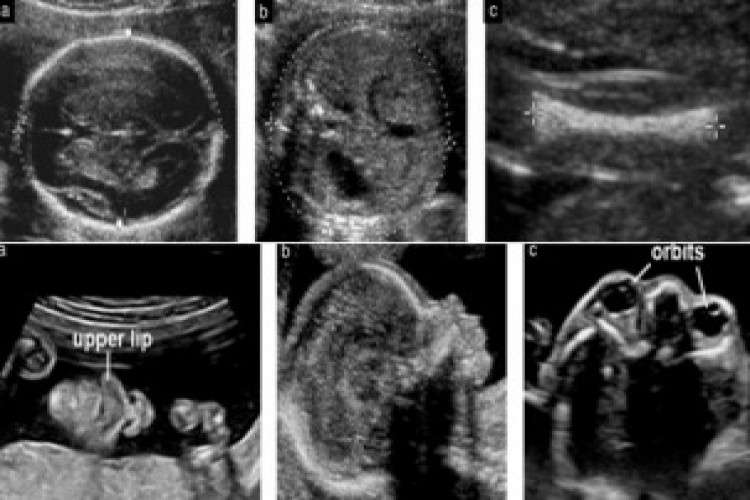 Anomaly Scan Center In Chennai 7172847