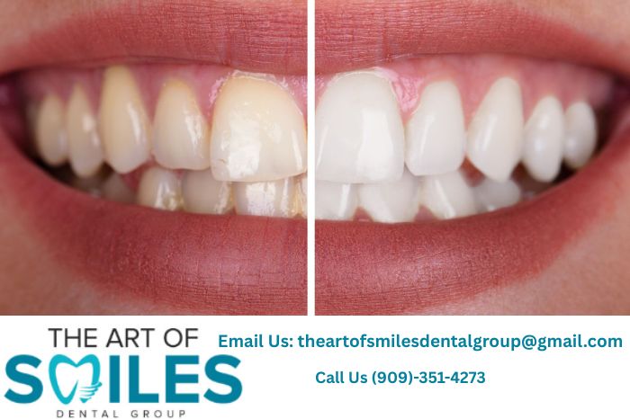 Art Of Smiles Fontana Dentist In Fontana 17690662086