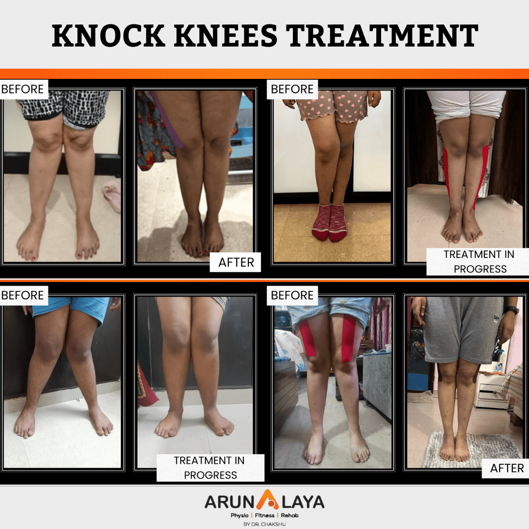 Arunalaya Physiotherapy 17349424019