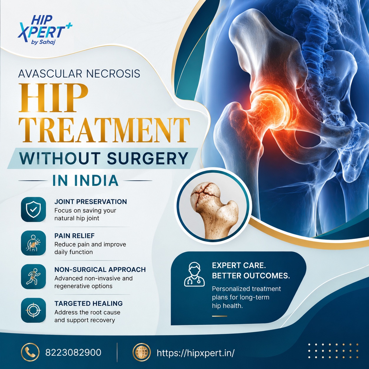 Avascular Necrosis Hip Treatment Without Surgery In India 178651942910