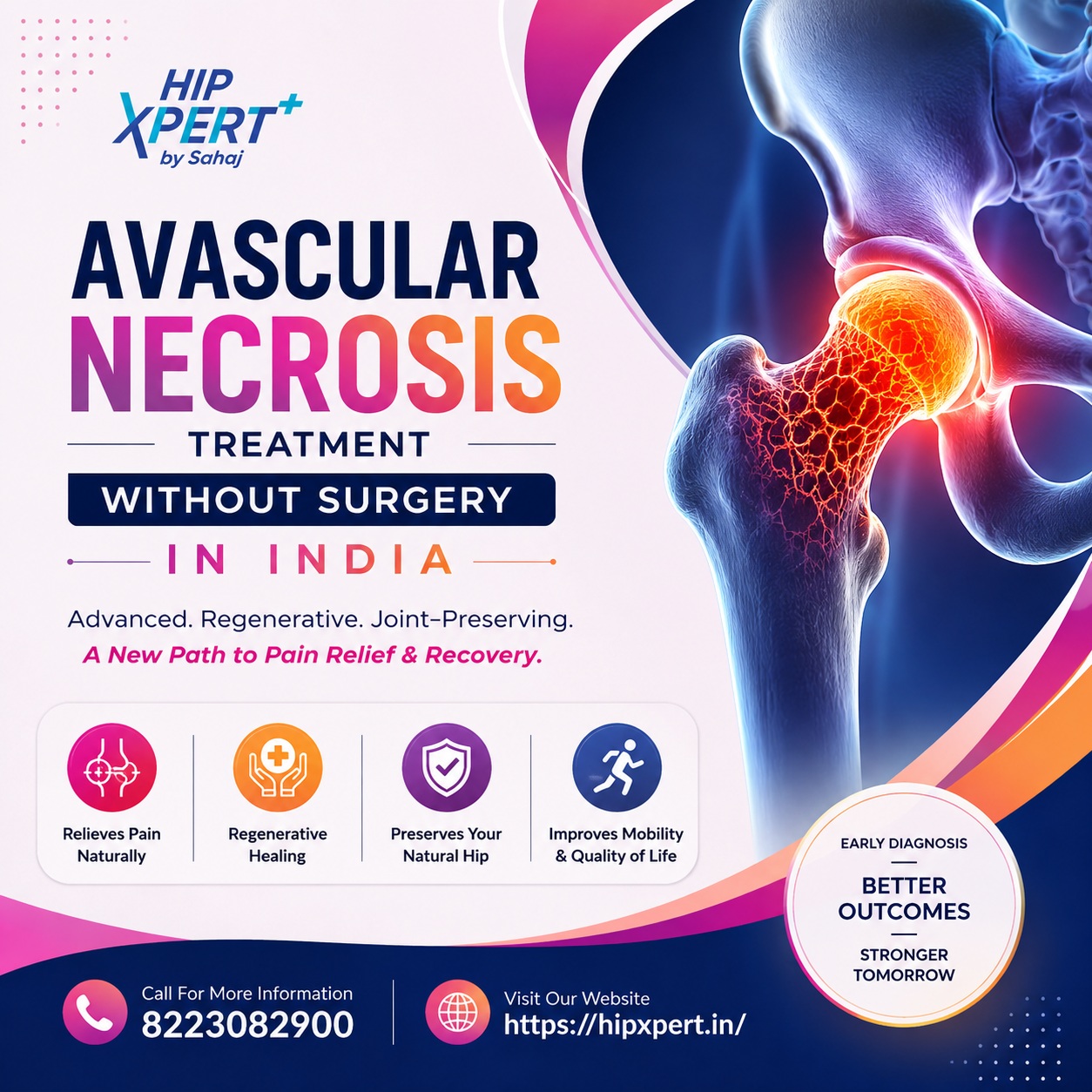 Avascular Necrosis Treatment Without Surgery In India   Hip Xpert 17869646687