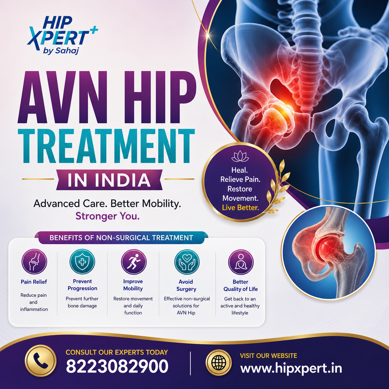 Avn Hip Treatment In India   Hipxpert 17920451048