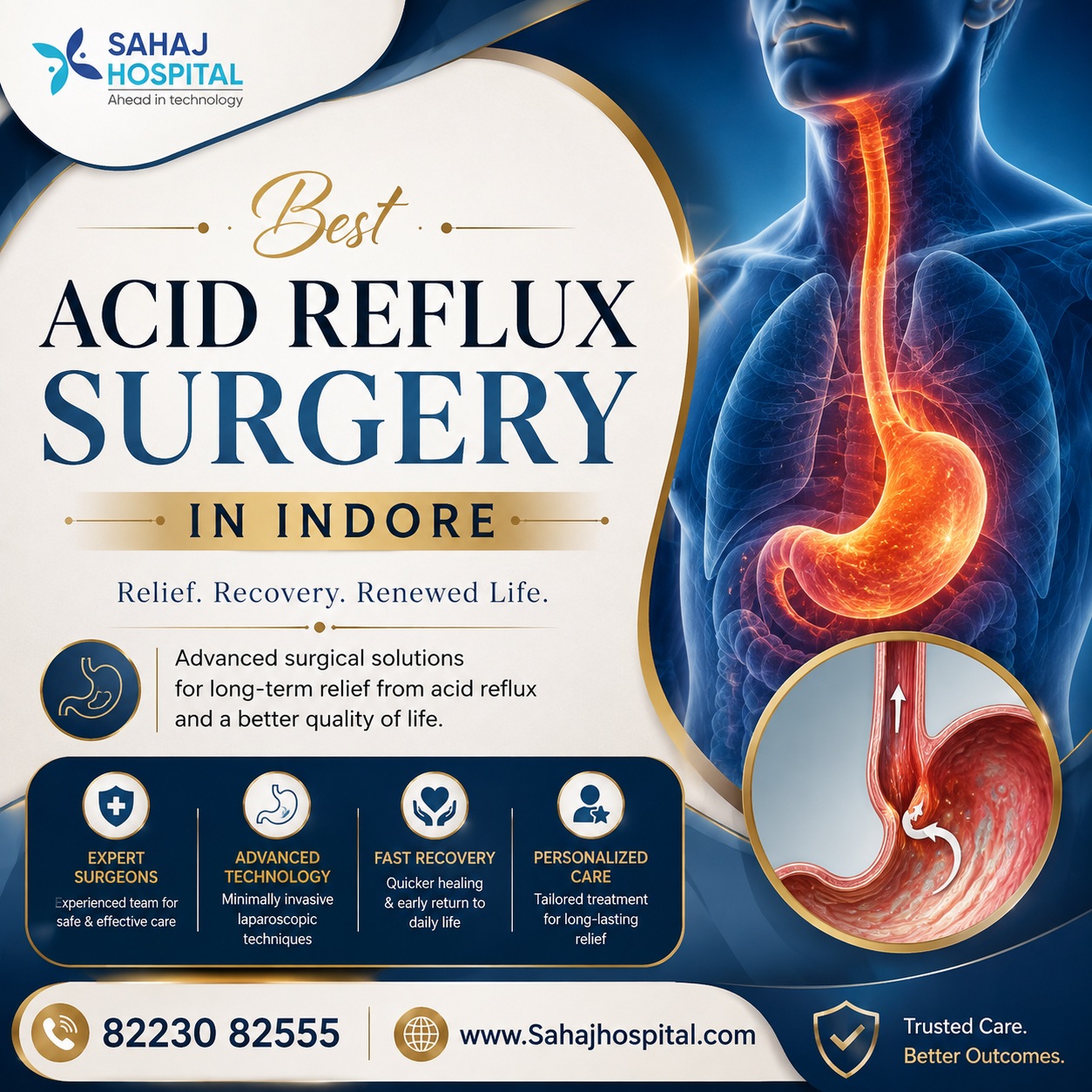 Best Acid Reflux Surgery In Indore   Sahaj Hospital 17863465527