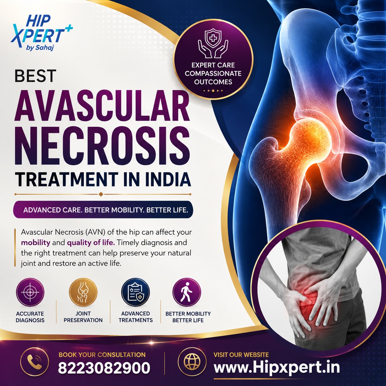 Best Avascular Necrosis Treatment In India   Hip Xpert 17872954731