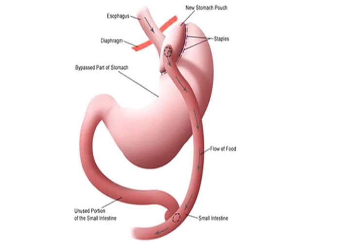 Best Bariatric Hospital In Coimbatore 7248857