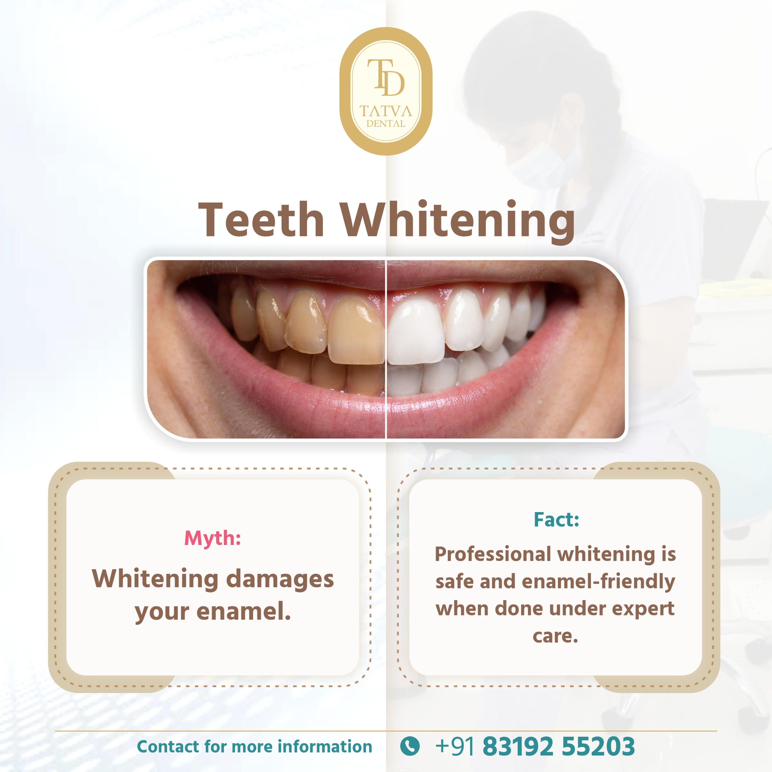 Best Clear Aligners And Invisible Braces Clinic 17520572515