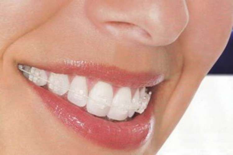 Best Dental Clinic In Gurgaon Aspen Dentals 6056038