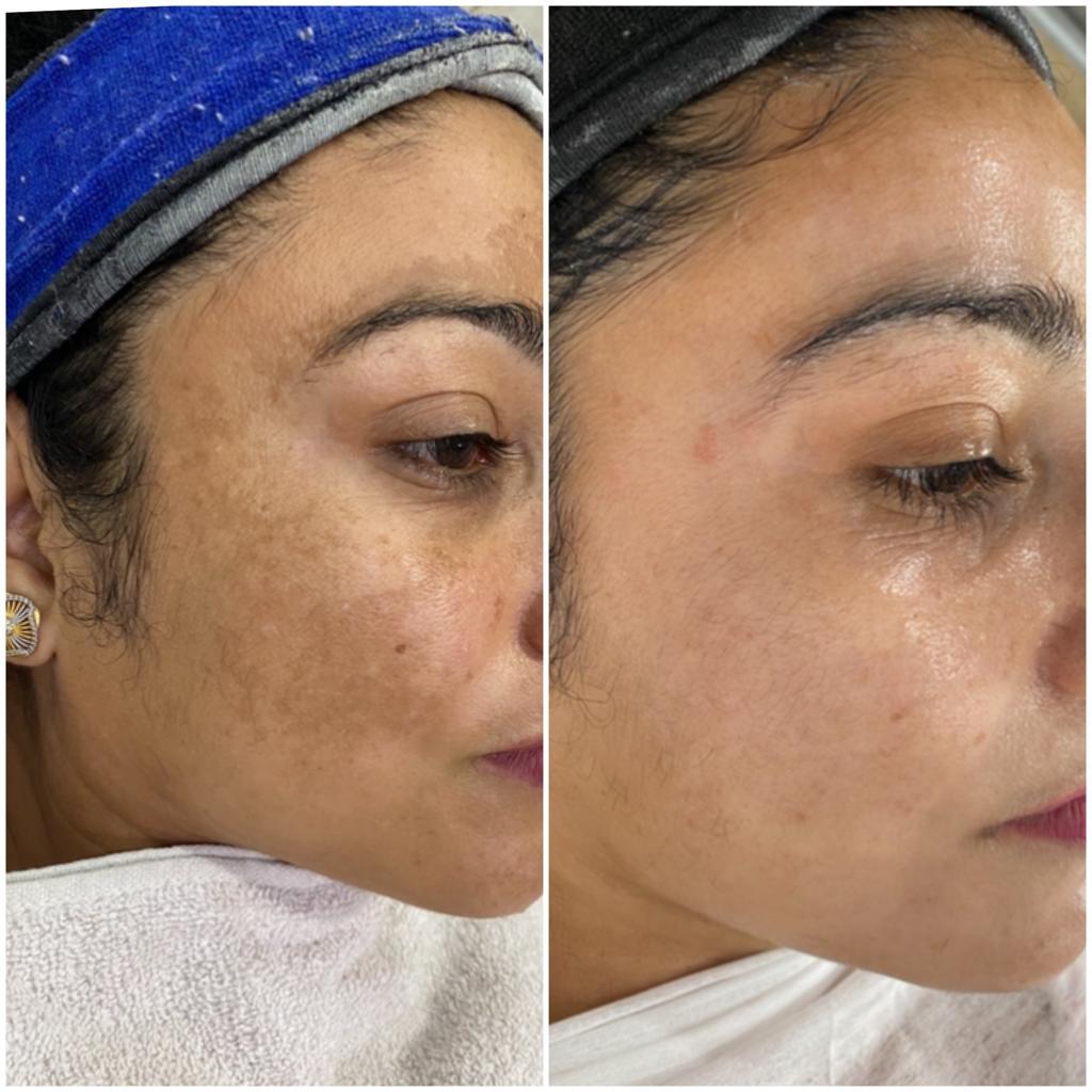 Best Dermatologist In Chandigarh   Gleuhr Clinic 17385654245