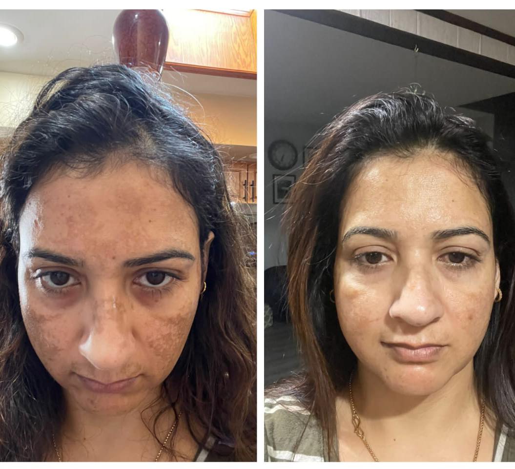 Best Dermatologist In Chandigarh   Gleuhr Clinic 17385654267