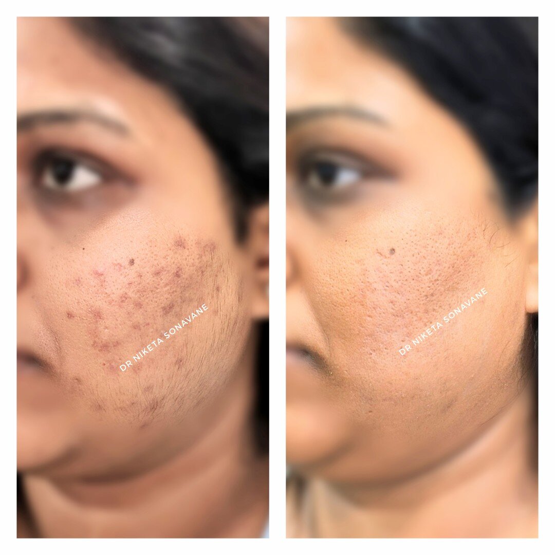 Best Dermatologist Near Me In Mumbai 173221378710