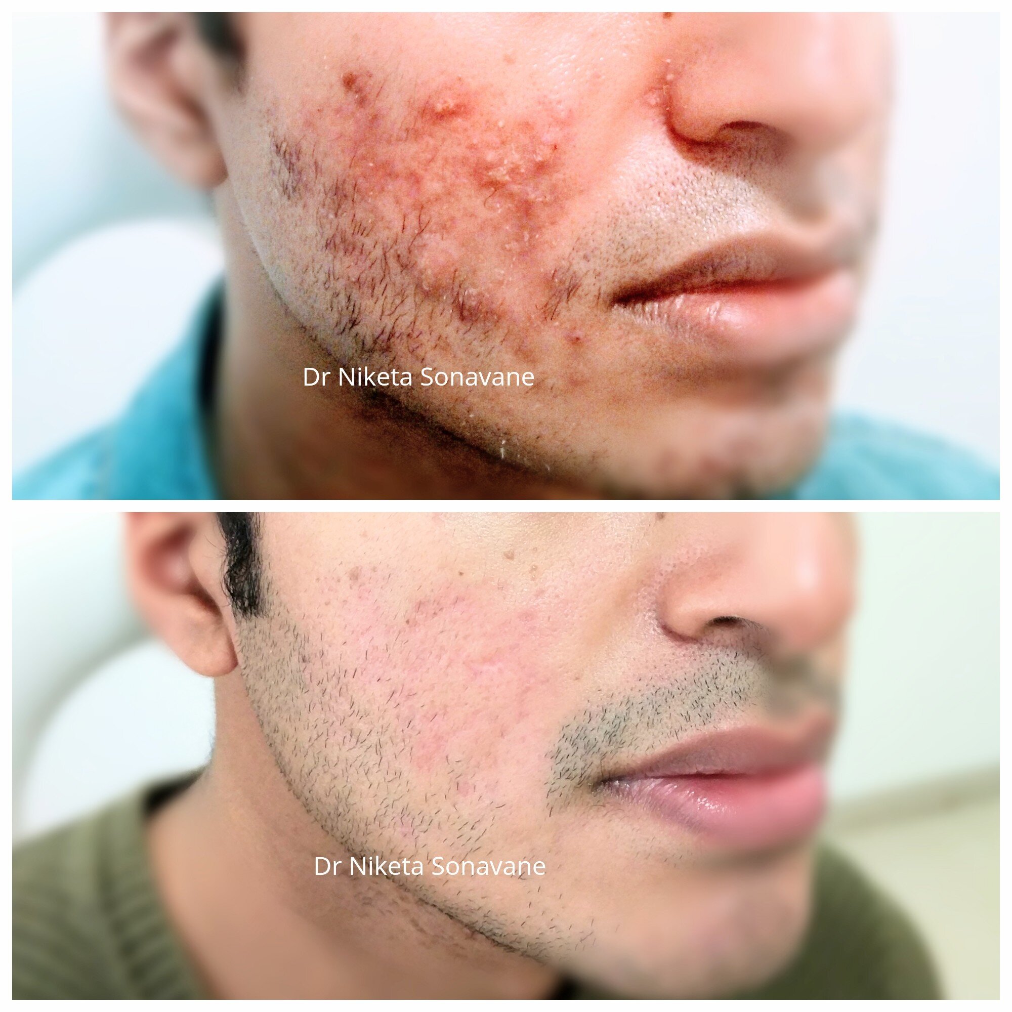 Best Dermatologist Near Me In Mumbai 17322137873