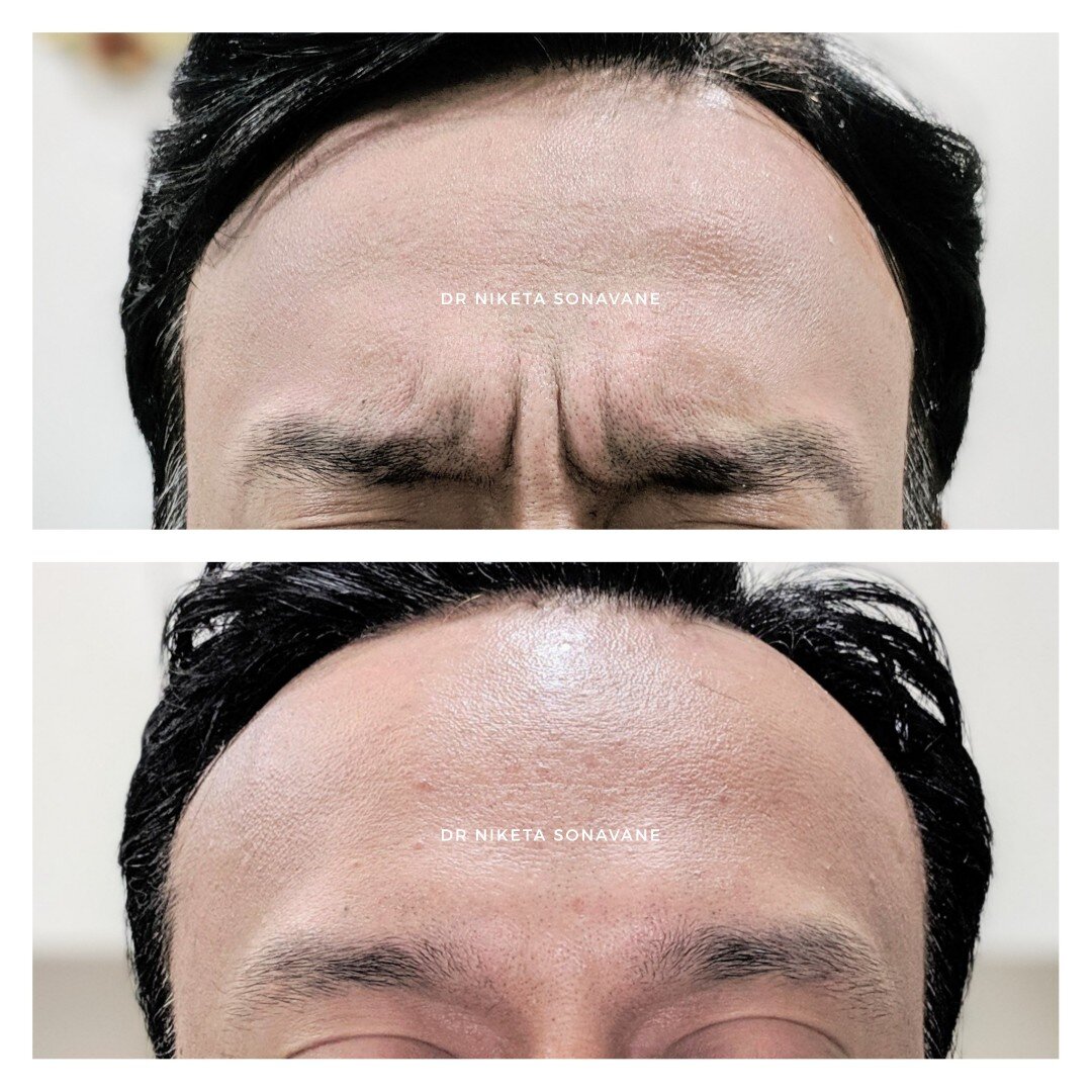 Best Dermatologist Near Me In Mumbai 17322137884