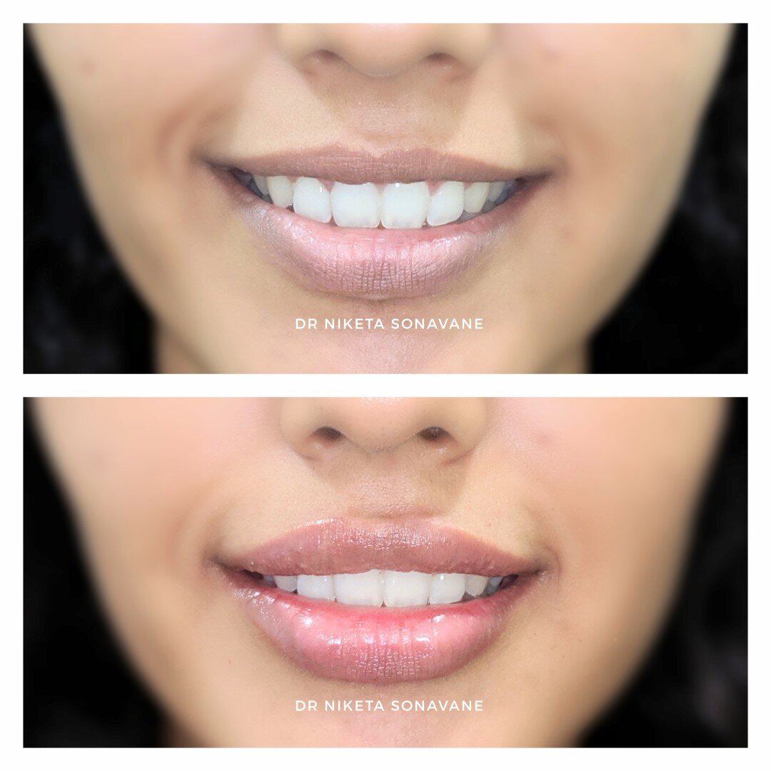 Best Dermatologist Near Me In Mumbai 17322137887