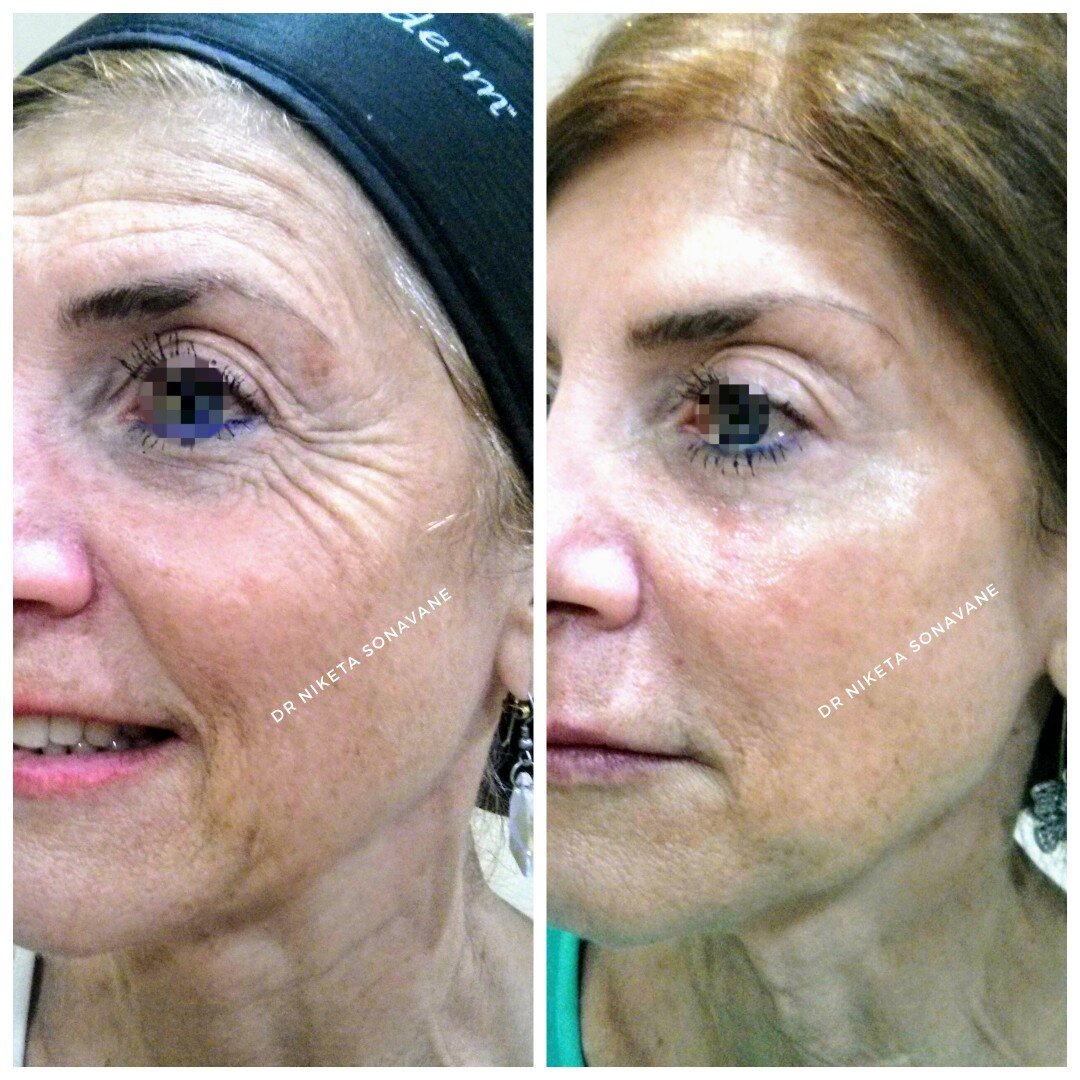 Best Dermatologist Near Me In Mumbai 17322137889