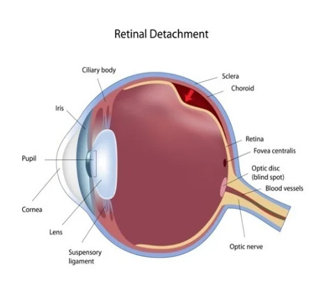 Best Eye Hospital In Howrah   Dristipath Eye Hospital 17652628491