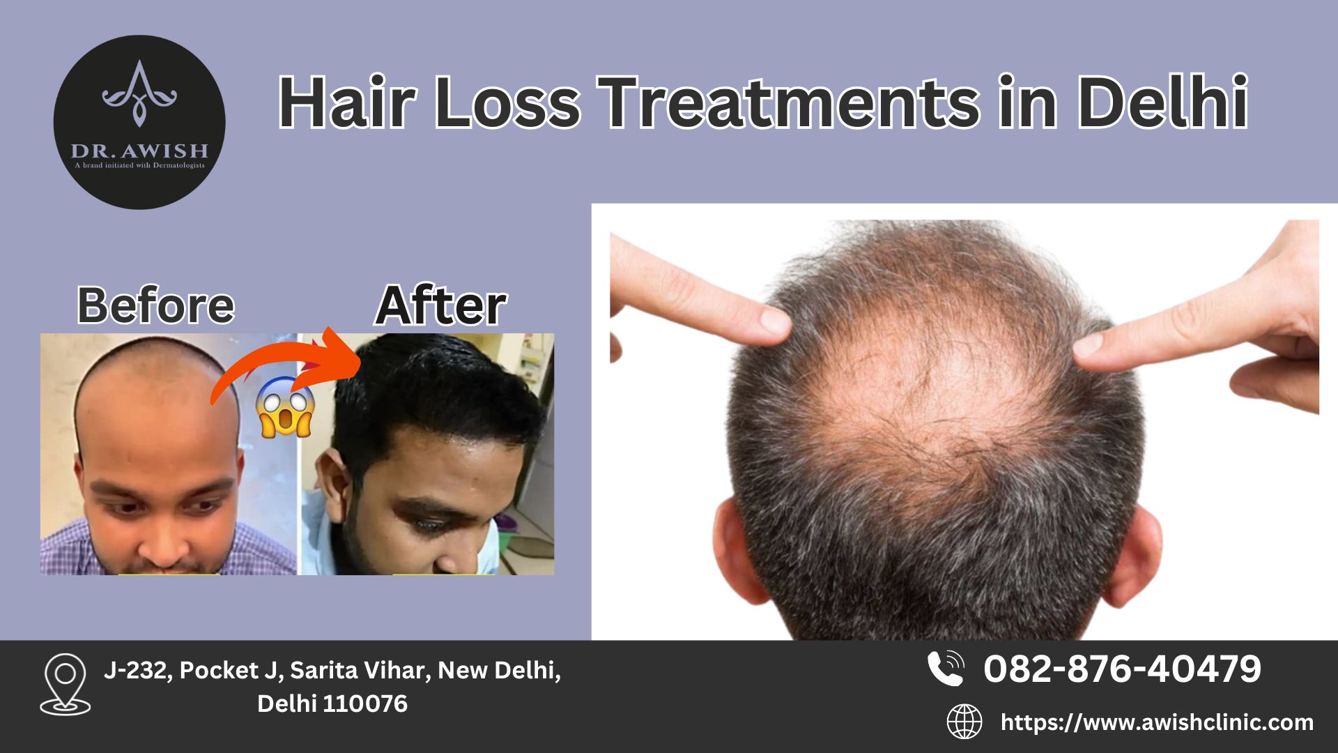 Best Hair Loss Treatment 17404771916