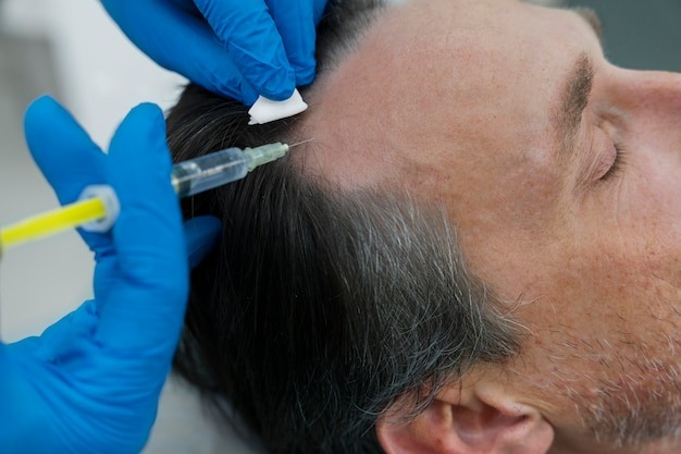 Best Hair Transplant Clinic In India For Advanced Restoration 17440213810