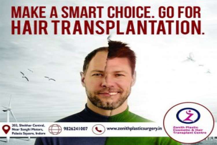 Best Hair Transplant In Indore 5140055