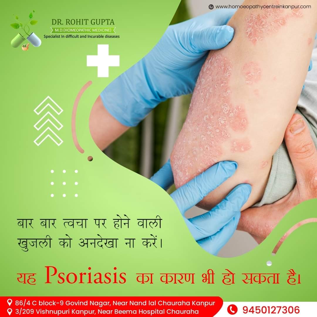 Best Pimples Acne Treatment In Kanpur Dermatologist Near Me 16762698479