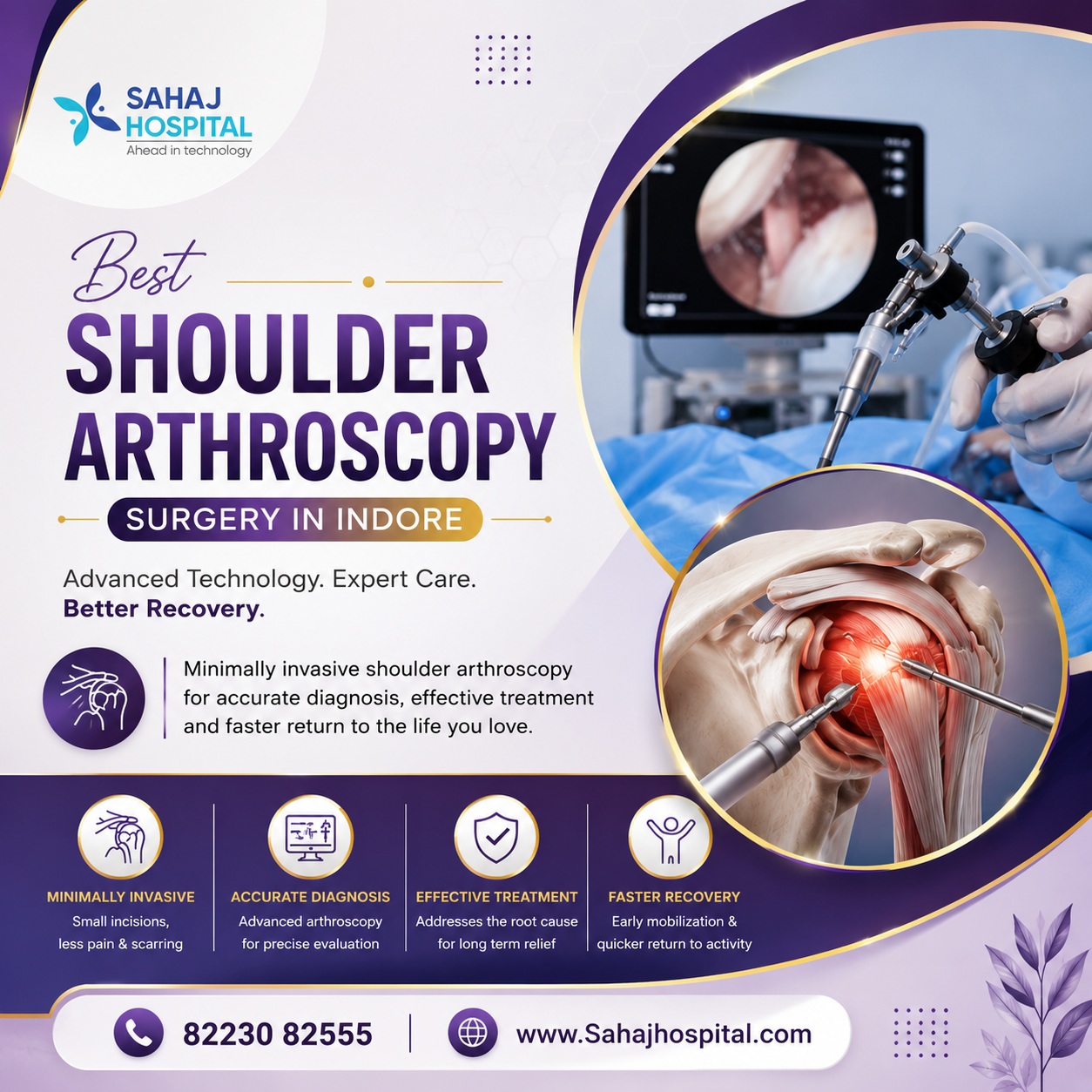 Best Shoulder Arthroscopy Surgery In Indore   Sahaj Hospital 17854028554