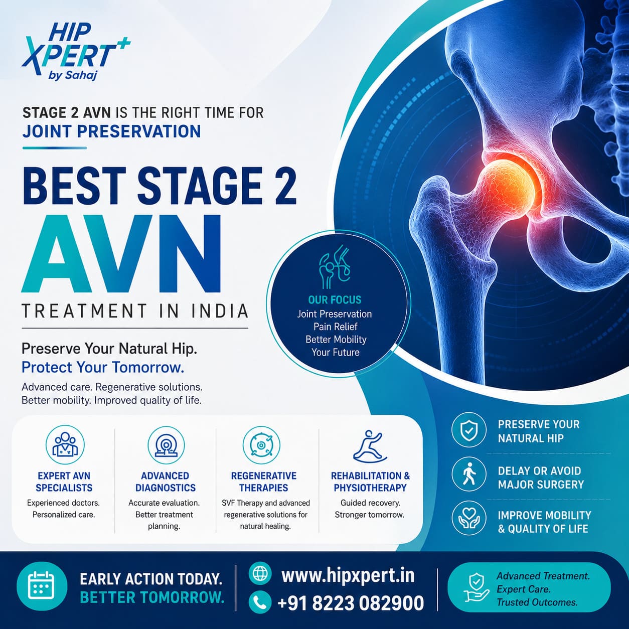 Best Stage Two Avn Treatment In India Hipxpert 17809853078