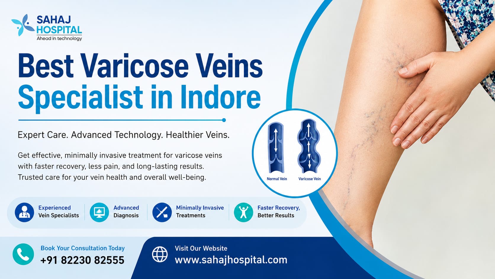 Best Varicose Veins Specialist In Indore 17796919002