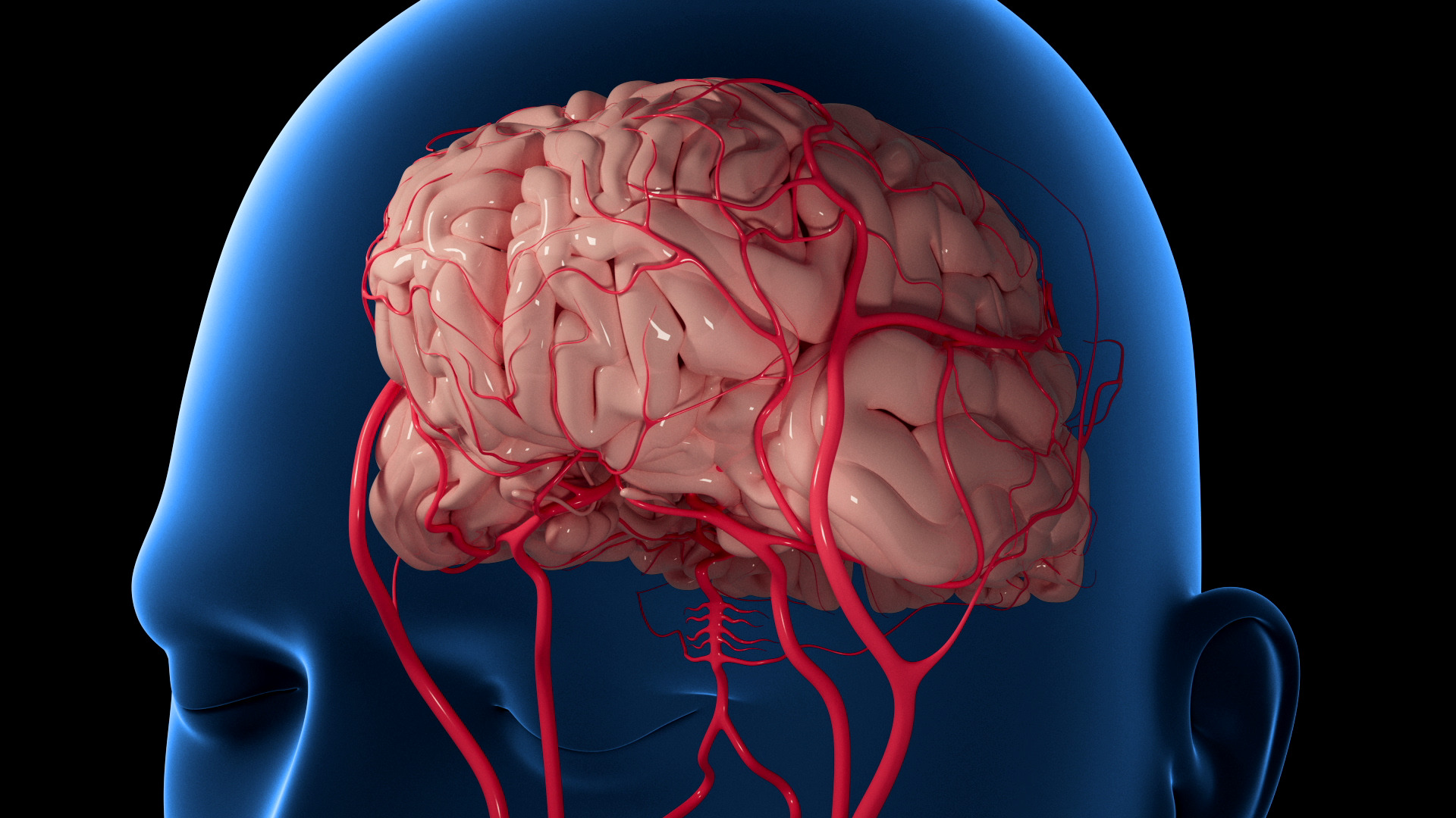 Brain Coiling Treatment For Safe Recovery 177891721510