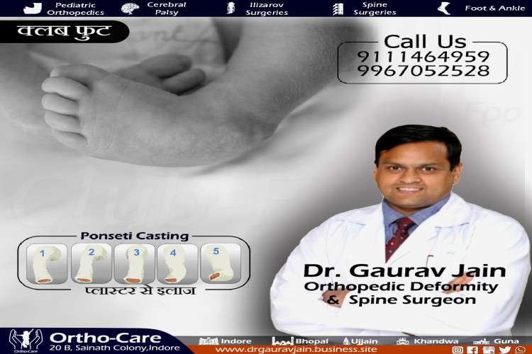 Club Foot Treatment At Indore By Dr Gaurav Jain 16408669131