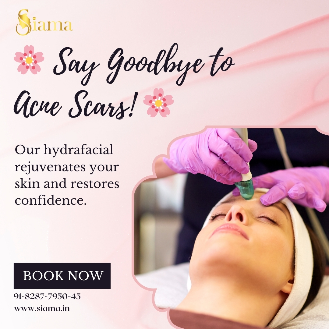 Deep Hydration Double The Glow Siama Hydraboost In Noida Ghaziabad 17483563896