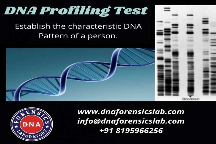 Dna Profiling Test In India 163585377410