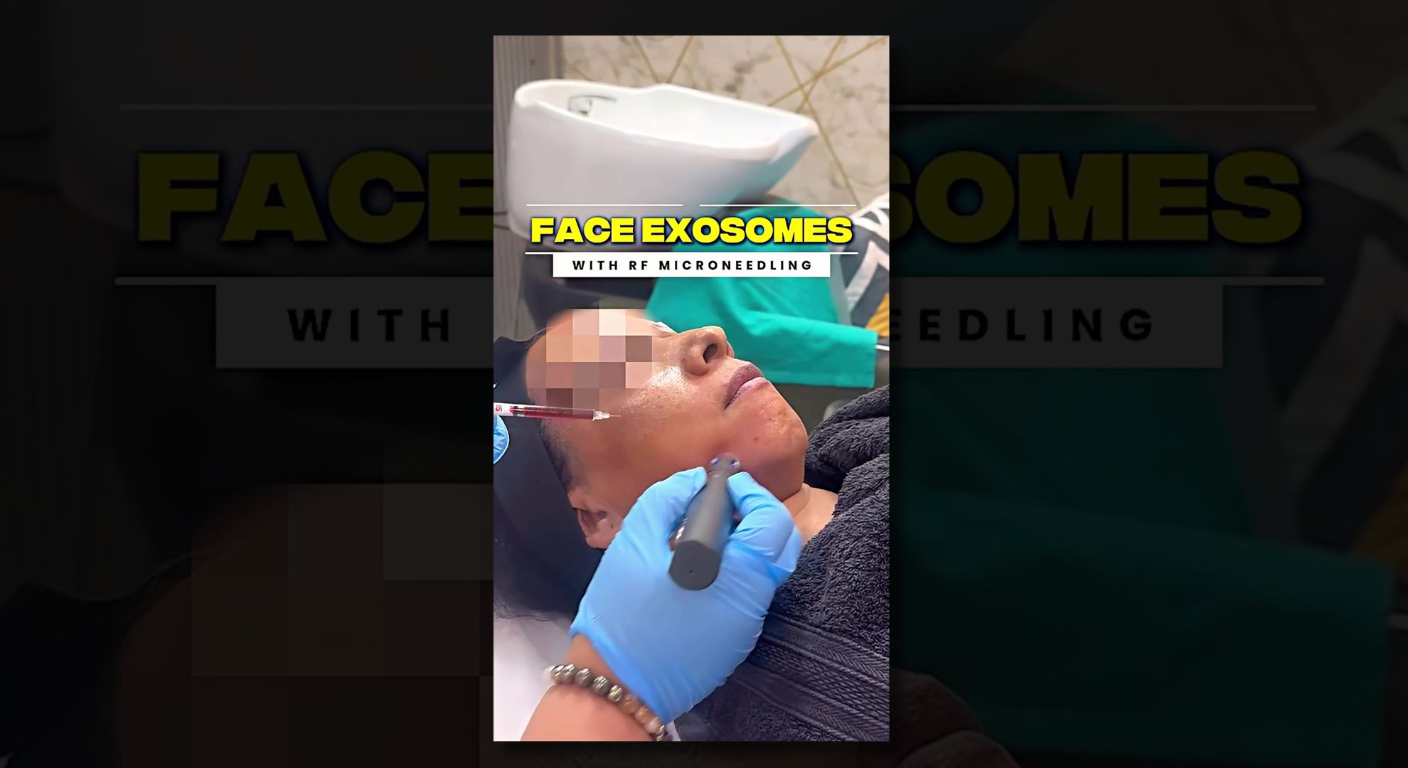 Face Exosomes Treatment In Gurgaon 17783207189