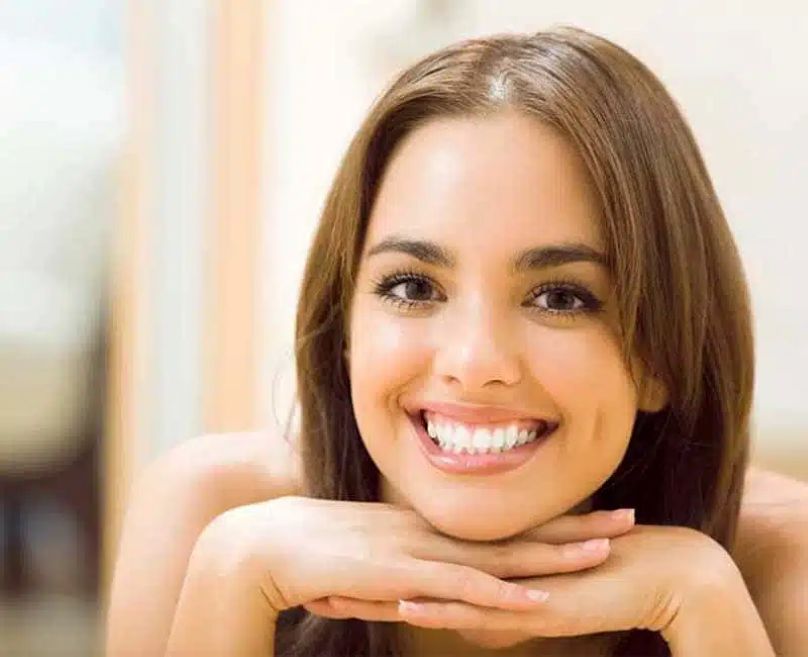 Gummy Smile Correction Treatment In Hyderabad At Fms Dental 17702105501