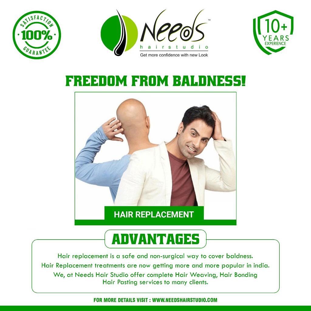 Hair Loss Treatment For Women In Hyderabad 17387729596