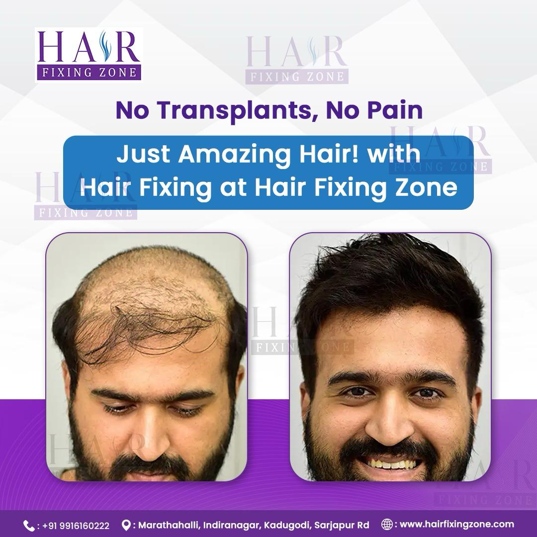 Hair Today Confidence Forever 17443519601