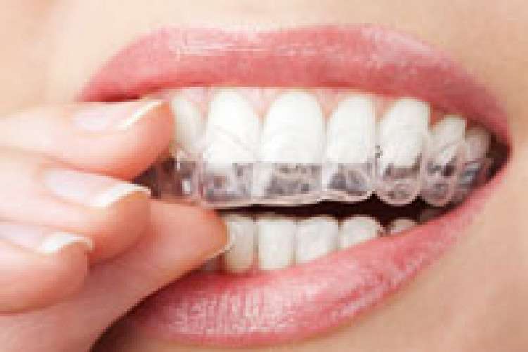 Immediate Dental Implants In Guntur 16375791816
