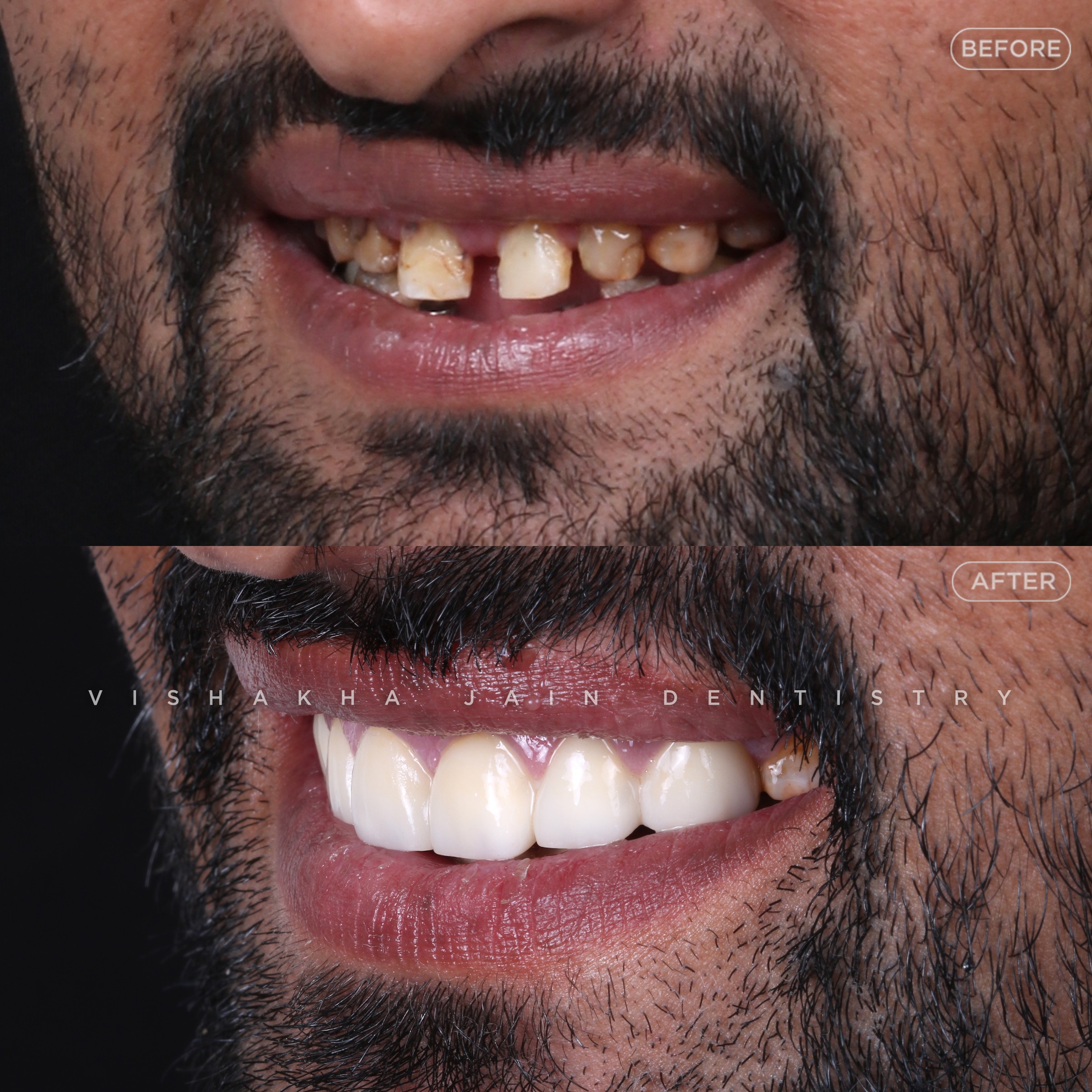 Indore Dental Clinic 17734949381