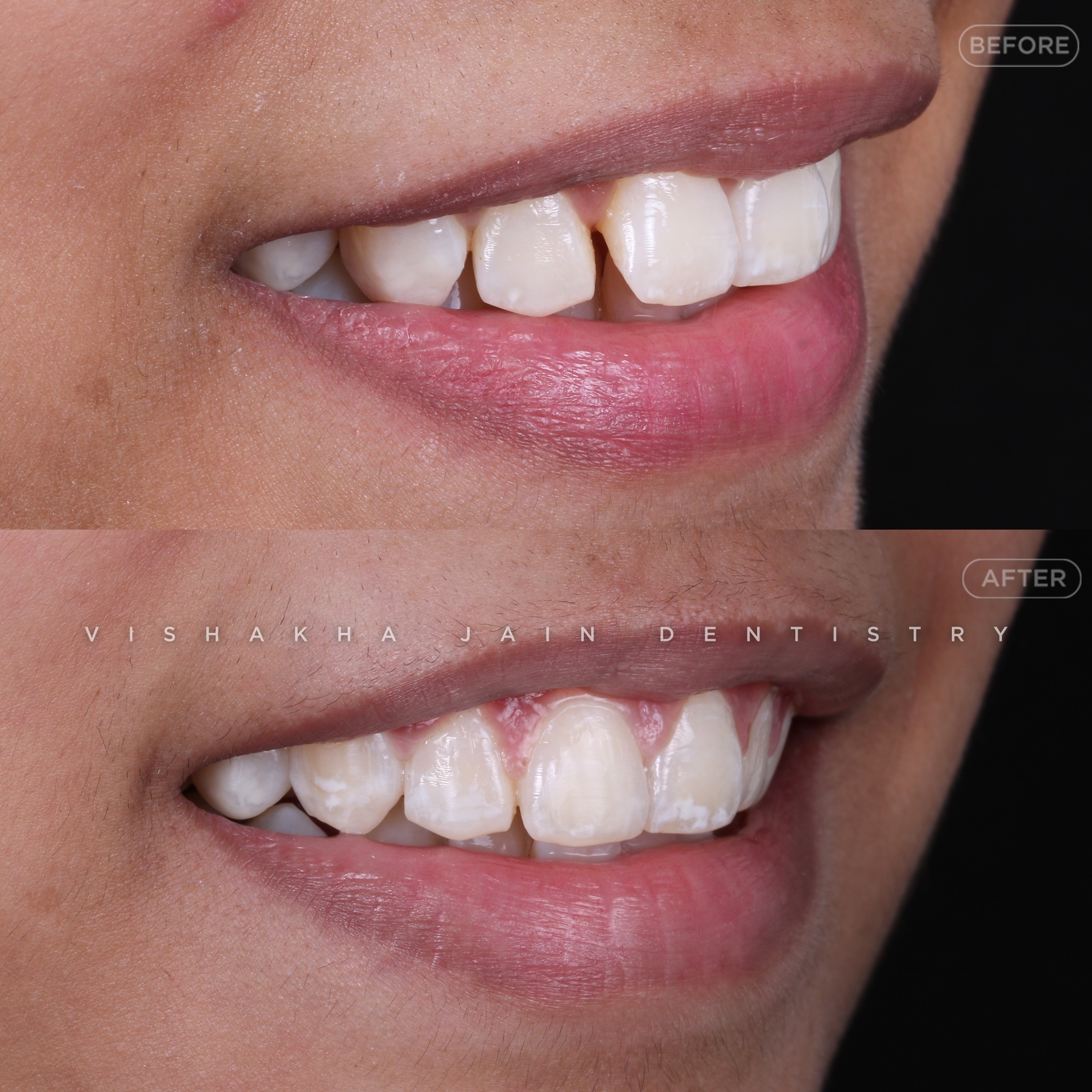 Indore Dental Clinic 177349493910