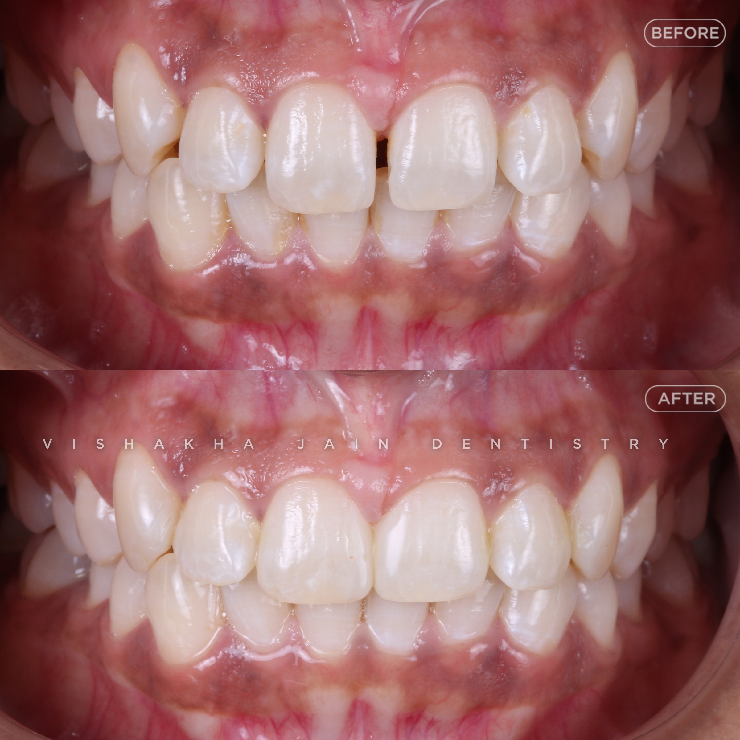 Indore Dental Clinic 17734949393