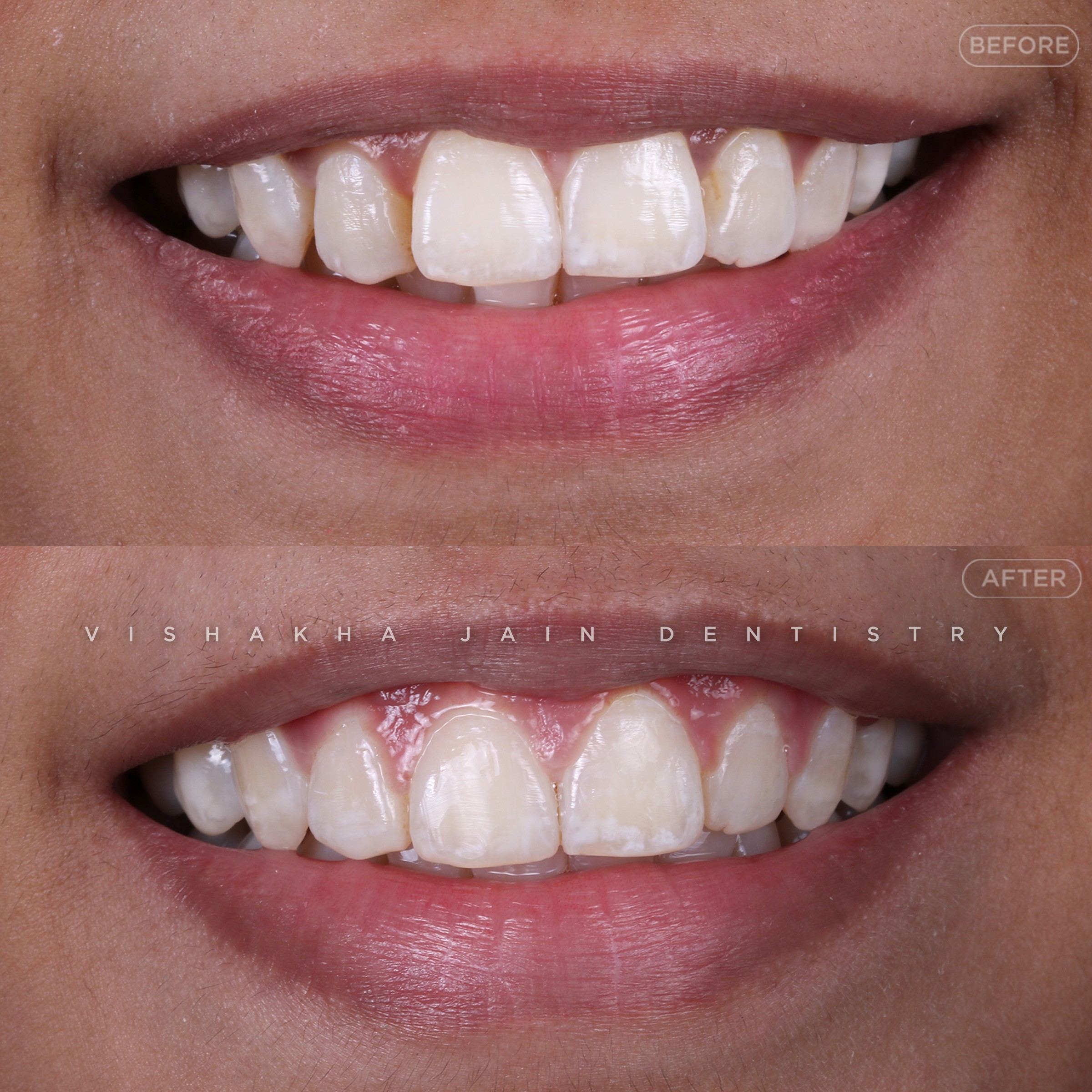 Indore Dental Clinic 17734949406