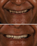 Ivore The Dental Studio Best Dental Clinic In Ahmedabad 17543903099