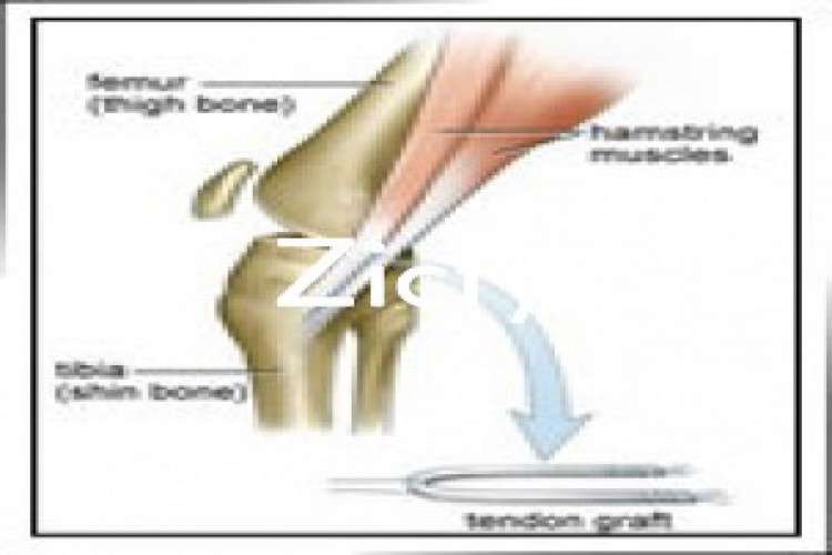 Knee And Shoulder Surgeon Mumbai  Dramrajani 7596947