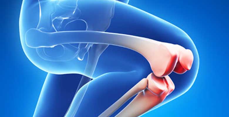 Knee Replacement Surgeon In Delhi 17013374626