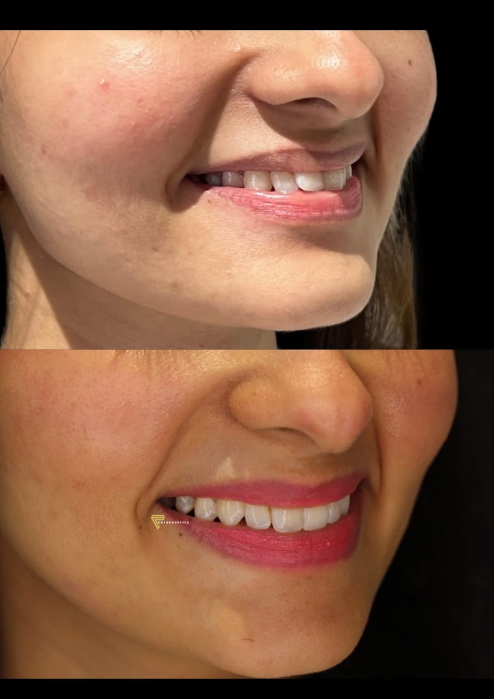 Looking For Best Dentist Near Me Visit Dental Clinic 17334726060